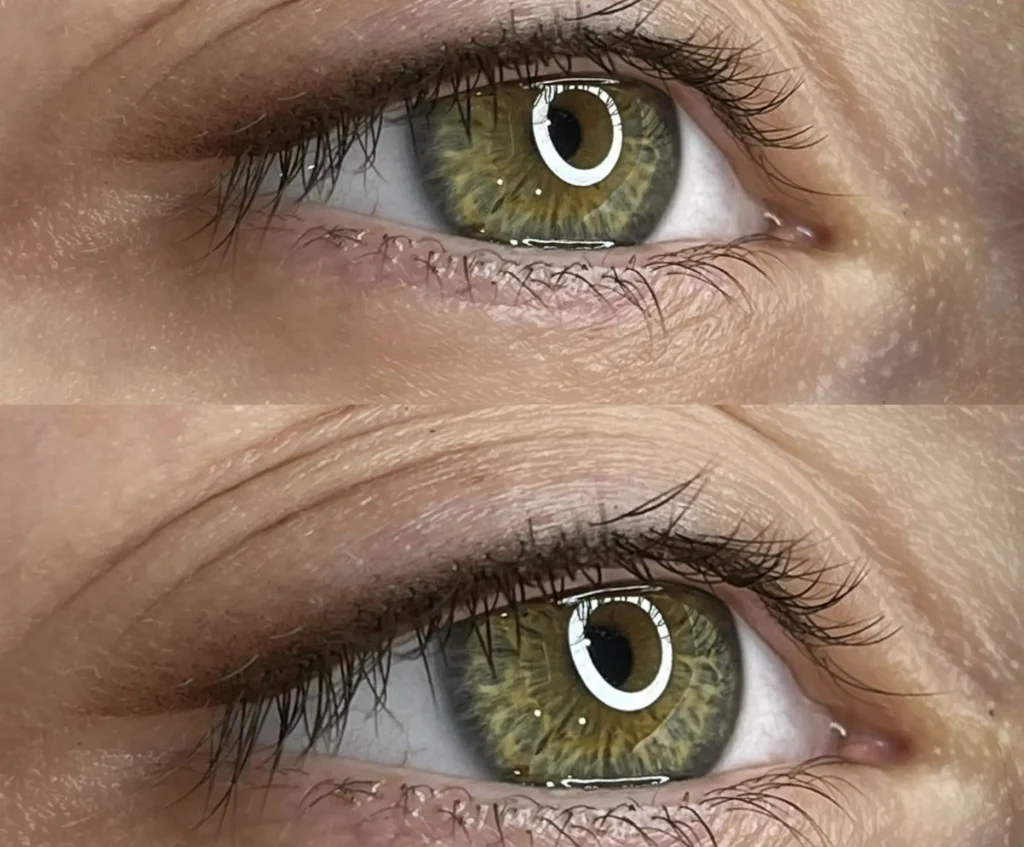 Eyeliner Tattoo Gone Wrong